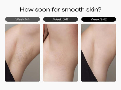 Ulike Air 3 - Ice Cooling IPL Hair Removal Device