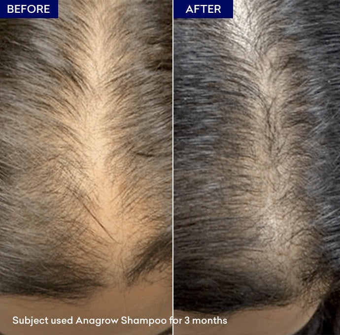 hair serum for hair growth