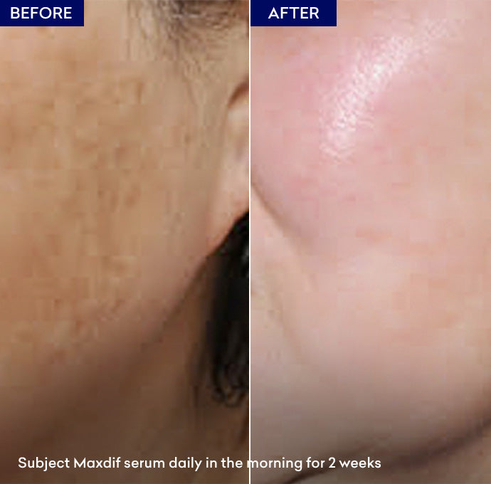 best skin brightening serum