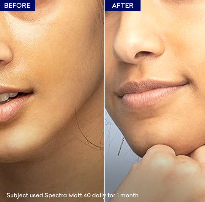 best spf for oily skin