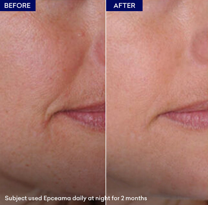 wrinkle serum