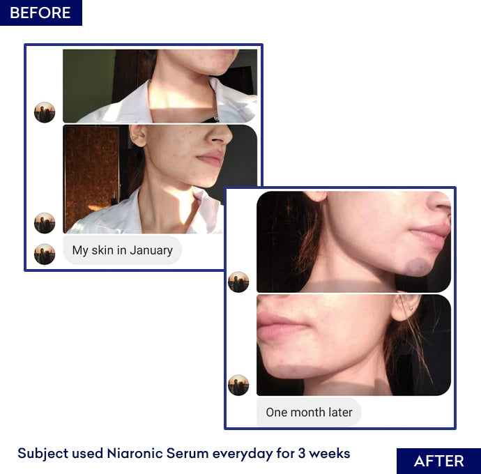 best serums