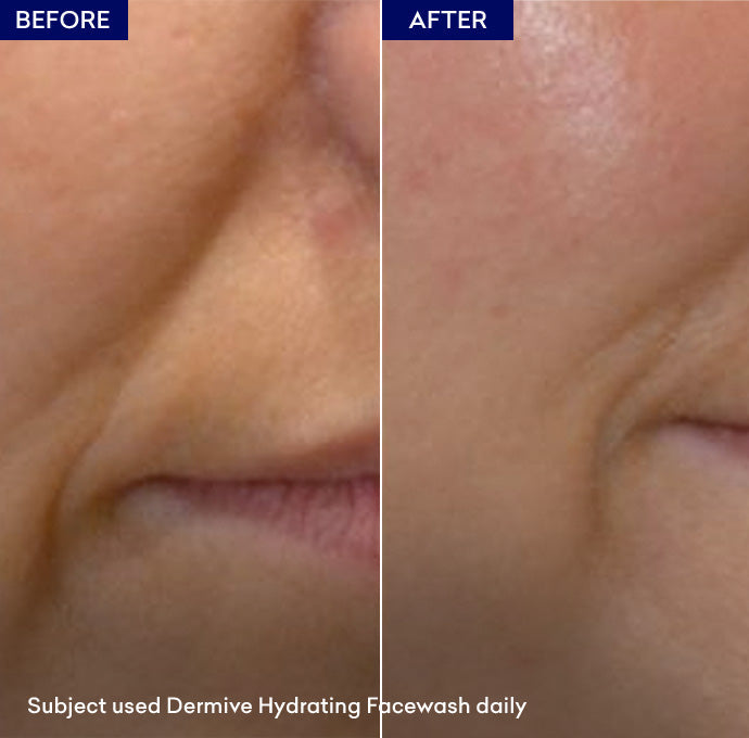 moisturizing face wash