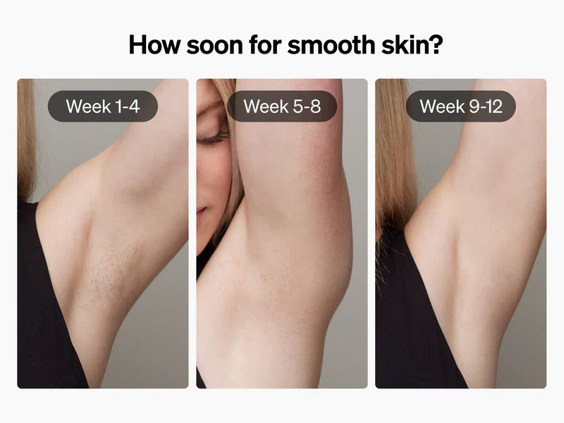 Ulike Air + - Ice Cooling IPL Hair Removal Device