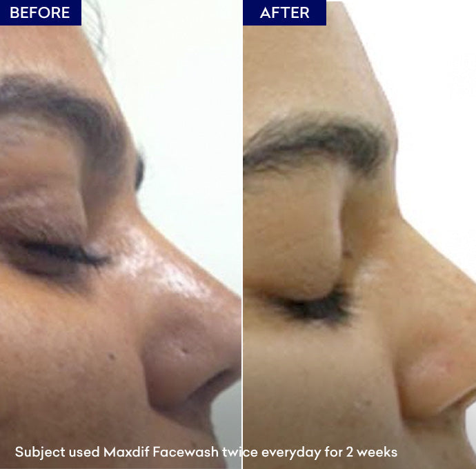vitamin c face wash